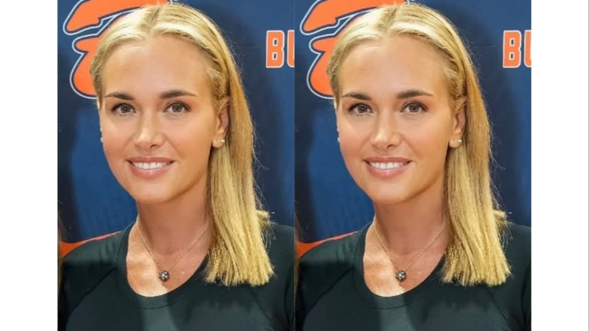 Vanessa Trump Discloses Breast Cancer Diagnosis and Begins Treatment as Public Figures Rally Support
